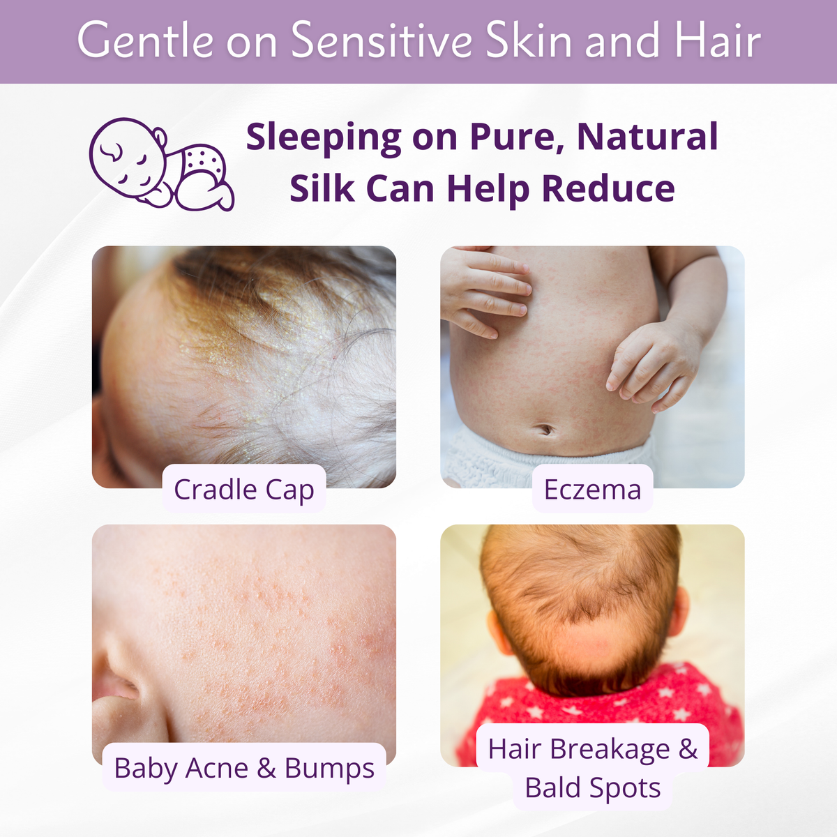 A graphic shows that sleeping on silk can help reduce cradle cap, eczema, baby acne, bumps, and hair breakage.